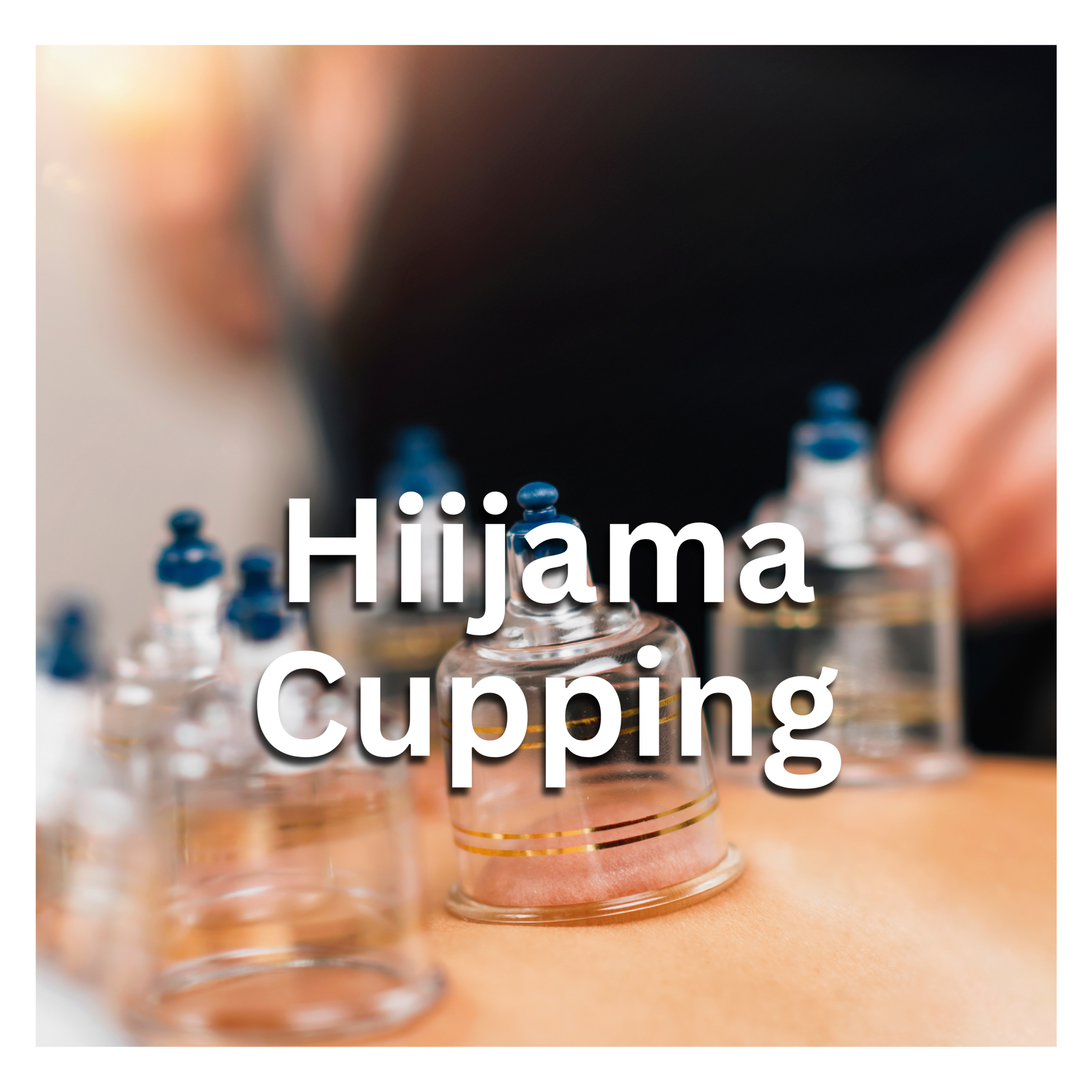 Hijama Cupping
